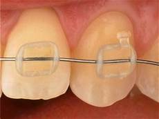 Orthodontics Equipments