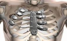 High-Temperature Alloys